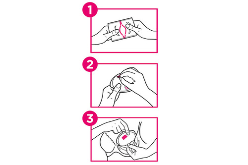 fisiopad-coussinet-aillaitement-lait-dtf-medical-schéma