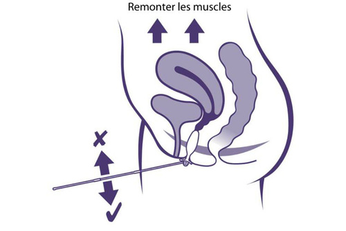 sonde-vaginale-periform-neen-performance-health-schéma